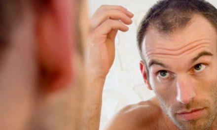 Can Hair Loss Be Prevented
