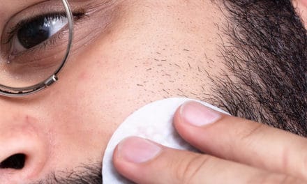 Skin Care Guide for Men – How to Treat Acne Scars With the Right Ingredients