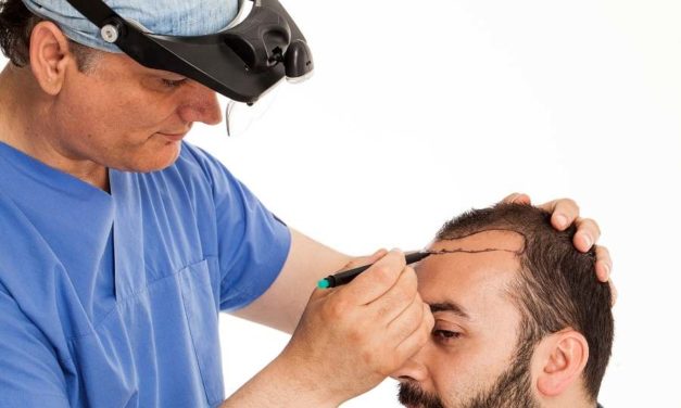 Eliminate Baldness With Hair Transplant In London