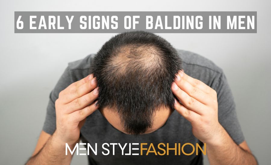 6 Early Signs Of Balding In Men